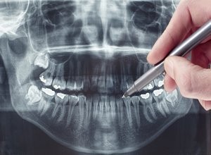 Záchovná a estetická stomatologie